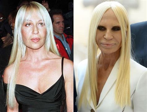 donatella versace wearing versace belted dress|donatella before and after.